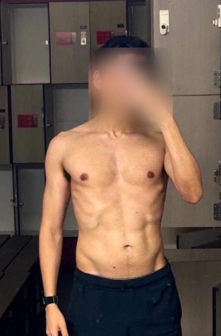 Same client after, face blurred