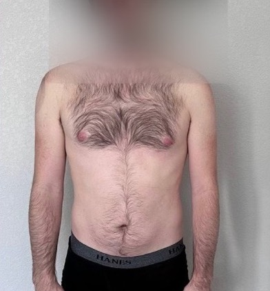 Client before, face blurred